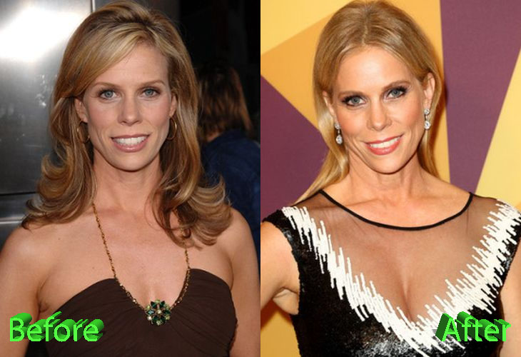 Cheryl Hines Before and After Plastic Surgery