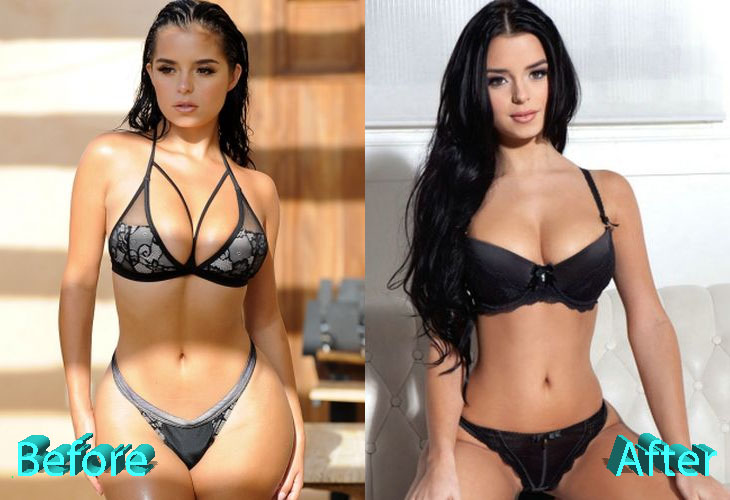 Demi Mawby Before and After Cosmetic Surgery