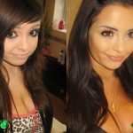 Demi Mawby Before and After Plastic Surgery 150x150
