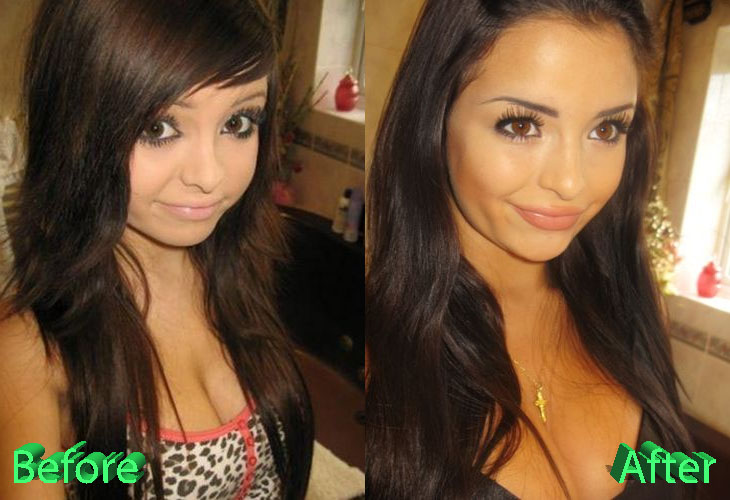 Demi Mawby Plastic Surgery: Growth Of The Instagram Star