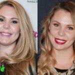 Kailyn Lowry Before and After Plastic Surgery 150x150