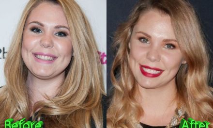 Kailyn Lowry Plastic Surgery: Not Shy About It At All