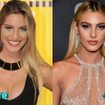Lele Pons Before and After Nose Job