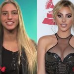 Lele Pons Before and After Nose Job Surgery