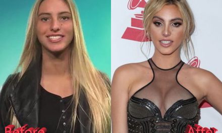 Lele Pons Nose Job: Lele’s Path from Youtube To beauty Queen