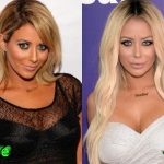 Aubrey ODay Before and After Plastic Surgery 150x150