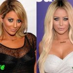 Aubrey O’Day Before and After Plastic Surgery