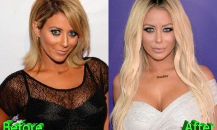 Aubrey O’Day Plastic Surgery: Pretty Big Changes For Aubrey