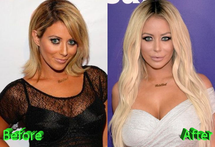 Aubrey O’Day Plastic Surgery: Pretty Big Changes For Aubrey