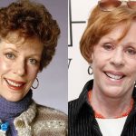 Carol Burnett Before and After Plastic Surgery 150x150