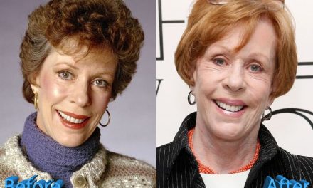 Carol Burnett Plastic Surgery: Is It An Addiction Or Not?
