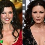 Catherine Zeta Jones Before and After Cosmetic Surgery 150x150