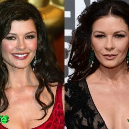 Catherine Zeta Jones Plastic Surgery: New Look For The Comeback