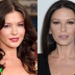 Catherine Zeta Jones Before and After Plastic Surgery 150x150