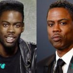 Chris Rock Before and After Cosmetic Surgery 150x150