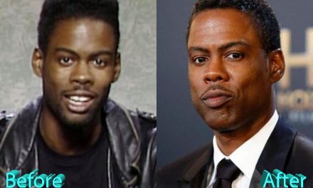 Chris Rock Plastic Surgery: A Real Improvement For Chris