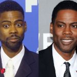 Chris Rock Before and After Plastic Surgery