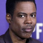 Chris Rock Plastic Surgery Gossips 150x150