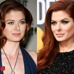 Debra Messing Before and After Plastic Surgery 150x150