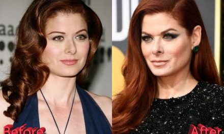 Debra Messing Plastic Surgery: “I’m not embarrassed at all”
