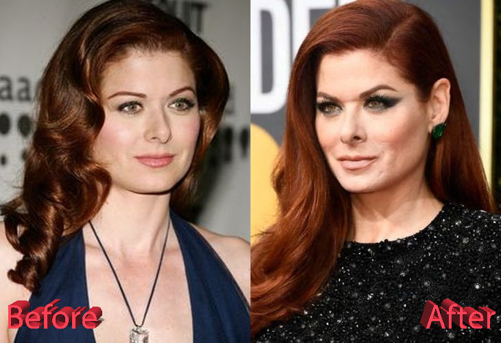 Debra Messing Plastic Surgery "I'm not embarrassed at all"