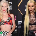 Iggy Azalea Before and After Plastic Surgery 150x150