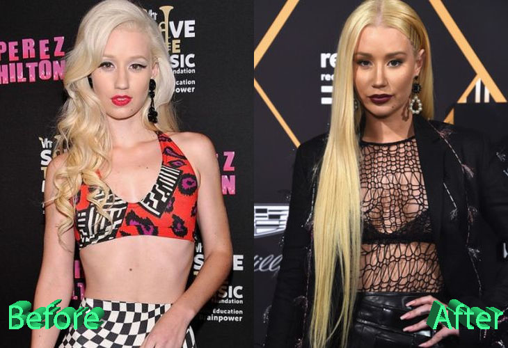 Iggy Azalea is an Australian rapper who moved to the U.S just at the age of...