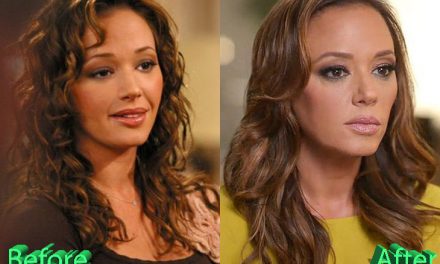 Leah Remini Plastic Surgery: Leah’s Newly Found Youth