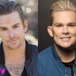 Mark McGrath Before and After Cosmetic Surgery