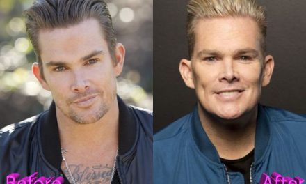 Mark Mcgrath Plastic Surgery: Mark’s Not So Subtle Changes