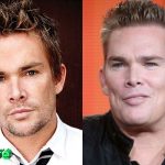 Mark McGrath Before and After Plastic Surgery