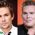 Mark McGrath Before and After Plastic Surgery