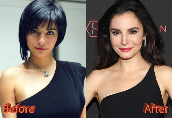 Martha Higareda Before and After Cosmetic Surgery
