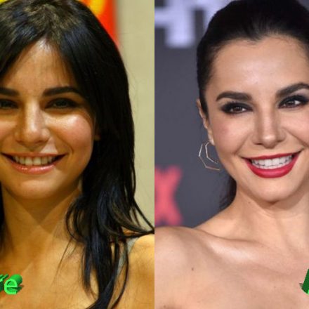 Detailed Martha Higareda Plastic Surgery Background in HD Detailed Martha Higareda Plastic Surgery Background in HD