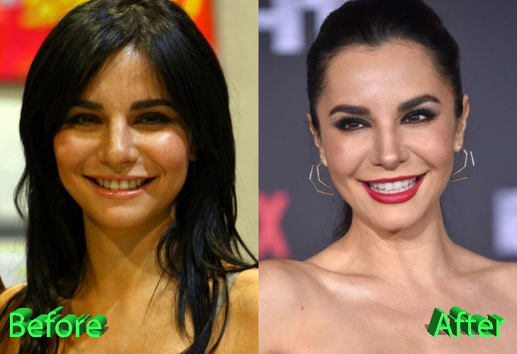 Martha Higareda Plastic Surgery: Looking Gorgeous As Ever