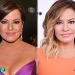 Robin Meade Before and After Plastic Surgery 150x150