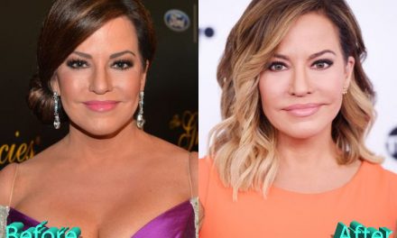 Robin Meade Plastic Surgery: Youthful Look For Robin