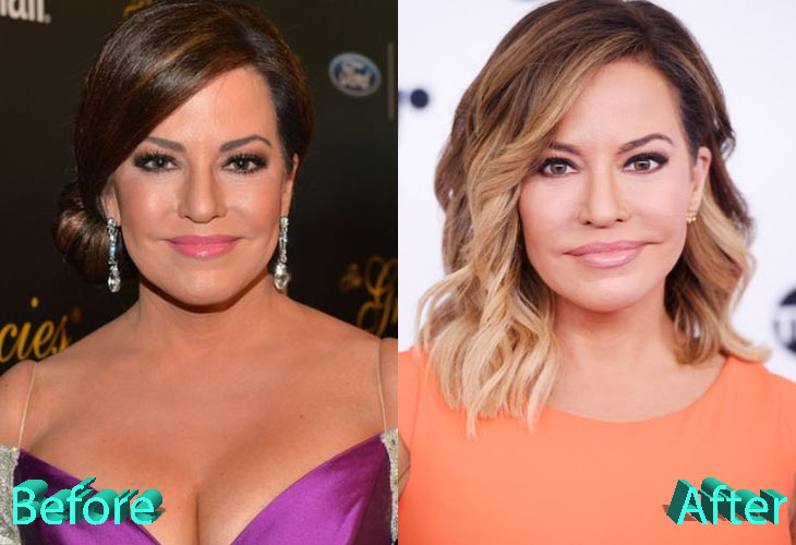 Robin Meade Plastic Surgery: Youthful Look For Robin.