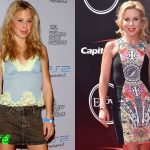 Tara Lipinski Before and After Cosmetic Surgery 150x150
