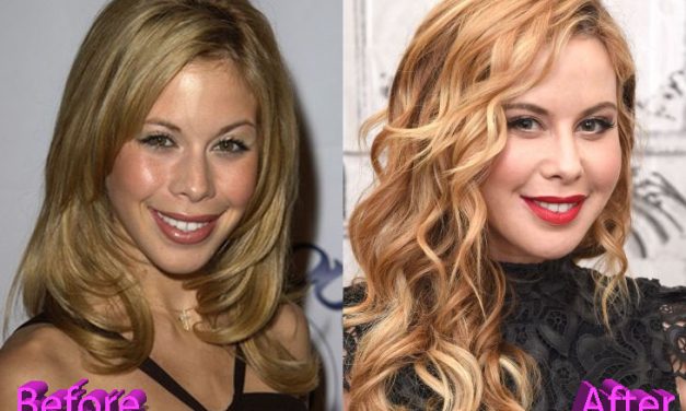 Tara Lipinski Plastic Surgery: Truth or Just Good Makeup? 🤫