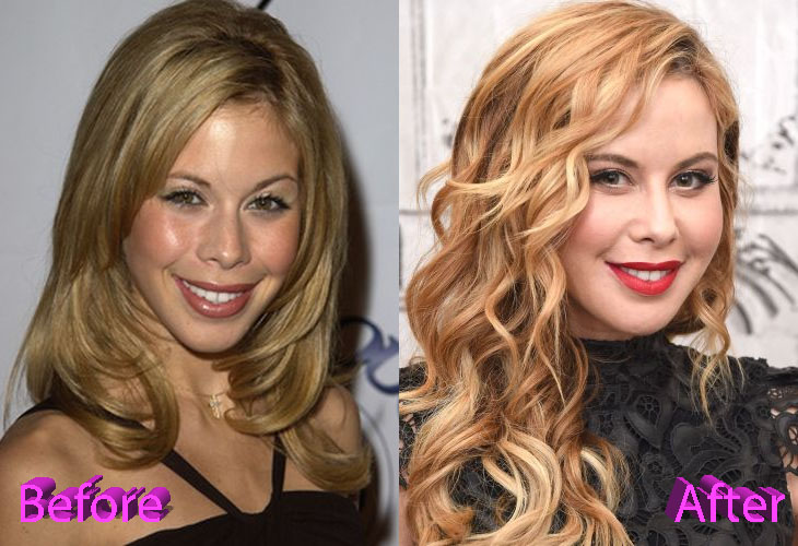 Tara Lipinski Plastic Surgery: New Look For Former Ice Skating Star