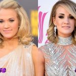 Carrie Underwood Before and After Cosmetic Surgery 150x150