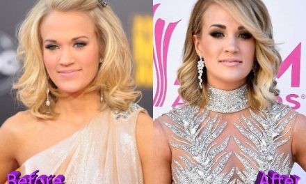 Carrie Underwood Plastic Surgery: Looking Better Than Ever