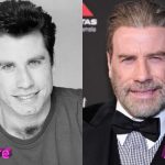 John Travolta Before and After Cosmetic Surgery
