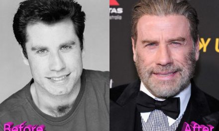 John Travolta Plastic Surgery: The Fear Of Getting Old?