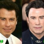 John Travolta Before and After Plastic Surgery