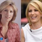 Laura Ingraham Before and After Cosmetic Surgery