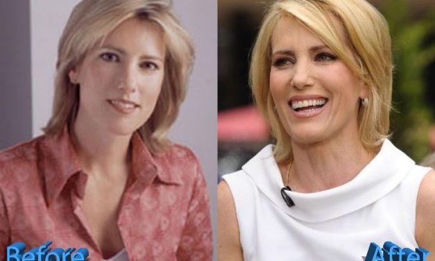 Has Laura Ingraham Had Plastic Surgery? Fans Are Divided