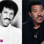 Lionel Richie Before and After Cosmetic Surgery 150x150