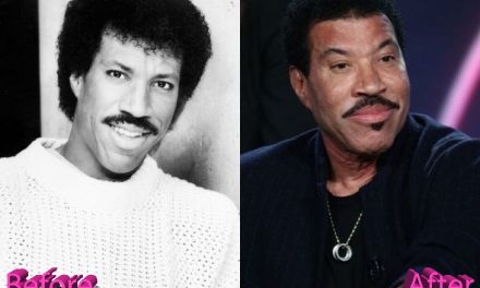 Lionel Richie Plastic Surgery: All You Need To Know About It